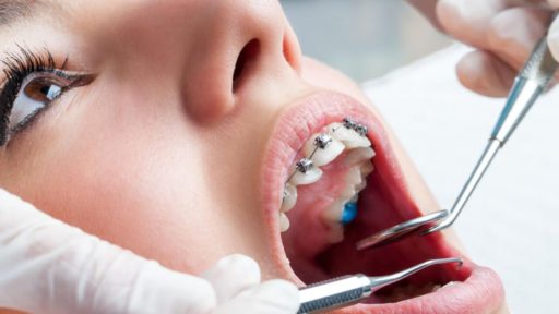 ortodontia-tratamentos-especialistas